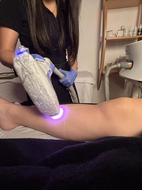 trattamenti estetici con macchinari a Scicli 4